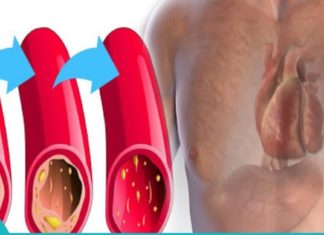 ეს პროდუქტები საოცარად ეხმარება არტერიებს ბაქტერიების გამოდევნაში. უმოკლეს დროში აჯანსაღებს არტერიებს.