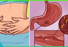 ნაყენთა ჩამონათვალი, რომლებიც ათავისუფლებს ორგანიზმს პარაზიტებისგან