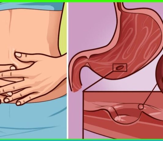 ნაყენთა ჩამონათვალი, რომლებიც ათავისუფლებს ორგანიზმს პარაზიტებისგან