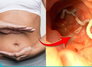 ხალხური საშუალებები პარაზიტების მოსაშორებლად