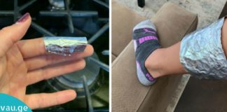 სახსრების მკურნალობა ფოლგით. სცადეთ და არ ინანებთ