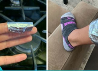 სახსრების მკურნალობა ფოლგით. სცადეთ და არ ინანებთ