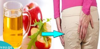 ბუასილის განკურნება უმოკლეს დროში მარტივად და იაფად