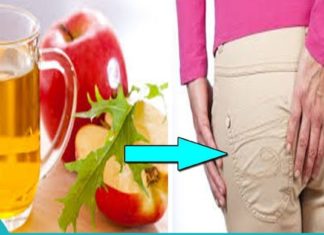 ბუასილის განკურნება უმოკლეს დროში მარტივად და იაფად