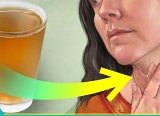 ჩიყვის ეფექტური სამკურნალო მეთოდები ხალხური მედიცინისგან