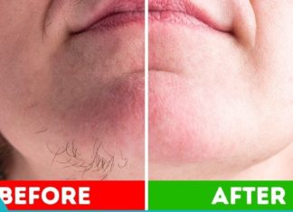 გასაოცარი მეთოდები არასასურველი თმების მოსაცილებლად სახლის პირობებში