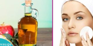 ნახეთ რა დაემართება თქვენს კანს თუ მას ვაშლის ძმრით დაიბანთ