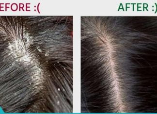 ქერტლის მკურნალობა სახლის პირობებში ხალხური მედიცინით