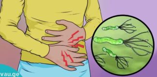 საუკეთესო სამკურნალო მეთოდი ჰელიკობაქტერ პილორის დროს