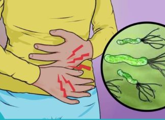 საუკეთესო სამკურნალო მეთოდი ჰელიკობაქტერ პილორის დროს