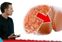 ღვიძლის ცხიმოვანი დისტროფიის მკურნალობა ამ გასაოცარი ბუნებრივი სასმელით!