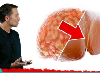 ღვიძლის ცხიმოვანი დისტროფიის მკურნალობა ამ გასაოცარი ბუნებრივი სასმელით!