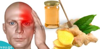 დაამარცხეთ შაკიკი ამ ნატურალური საშუალებებით