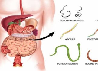 ჭიის მკურნალობა ხალხური მეთოდით უმოკლეს დროში