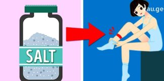 6 ნიშანი იმისა რომ გადაჭარბებული რაოდენობითაა მარილი ჩვენს ორგანიზმში