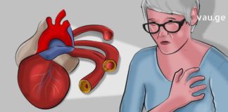 გულ-სისხლძარღვთა პათოლოგიები განსაკუთრებით ზაფხულში ხდება პრობლემური. რეკომენდაციები იხილეთ ამ სტატიაში