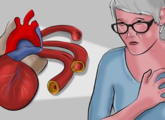 გულ-სისხლძარღვთა პათოლოგიები განსაკუთრებით ზაფხულში ხდება პრობლემური. რეკომენდაციები იხილეთ ამ სტატიაში