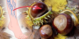 ცხენის წაბლის გამაოგნებელი მალამო ვარიკოზული ვენების სამკურნალოდ.