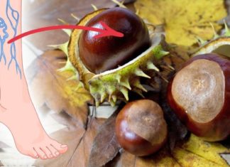 ცხენის წაბლის გამაოგნებელი მალამო ვარიკოზული ვენების სამკურნალოდ.