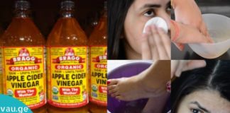 15 მიზეზი რატომ უნდა გამოიყენოთ ვაშლის ძმარი?!