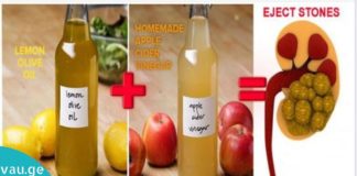 Შეურიეთ ზეითუნის ზეთი, ლიმონის წვენი და ვაშლის ძმარი, რომ გაიწმინდოთ ადვილად თირკმელები