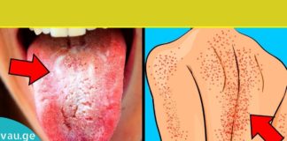 გაიწმინდეთ სხეული სასწრაფოდ, თუ ამ 9 ნიშნიდან ერთს მაინც გრძნობთ!