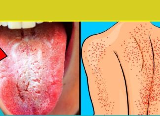 გაიწმინდეთ სხეული სასწრაფოდ, თუ ამ 9 ნიშნიდან ერთს მაინც გრძნობთ!