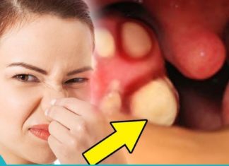 Მოიცილეთ კბილებზე ნადები, ქვები და ბაქტერიები, რომლებიც იწვევს პირის ღრუს არასასურველ სუნს, სულ რაღაც ერთი ინგრედიენტის დახმარებით!