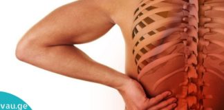 როგორ დავაღწიოთ თავი ზურგის ტკივილს? გამოიყენეთ ეს საშუალებები და ტკივილი გაქრება სამუდამოდ!
