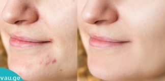 სახლში დამზადებული ტონიკები სახის გასაწმენდად