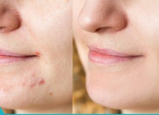 სახლში დამზადებული ტონიკები სახის გასაწმენდად