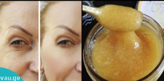 სილამაზის ნიღაბი თაფლის, სახამებლისა და მარილის კომბინაციით