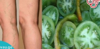 იცით, რომ მწვანე პიმიდორს შეუძლია დაეხმაროს ვარიკოზული ვენების მკურნალობას?