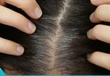 რატომ ჭაღარავდება თმა დროზე ადრე? როგორ შევაჩეროთ?