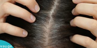 რატომ ჭაღარავდება თმა დროზე ადრე? როგორ შევაჩეროთ?