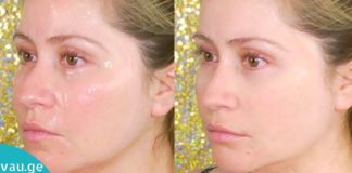 დაიბანეთ ამ საშუალებით სახე ყოველ დილით და სამუდამოდ დაივიწყეთ ნაოჭები და პრობლემური კანი! რეცეპტი ძალიან მარტივია!