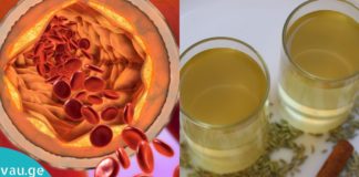 Სუფთა სისხლძარღვებისთვის მხოლოდ ერთი ჭიქა ეს სასმელი გამოიყენეთ!