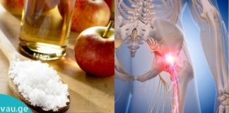 საჯდომის ნერვის ანთებისგან გათავისუფლდებით ამ მეთოდით სულ რაღაც 10 წუთში