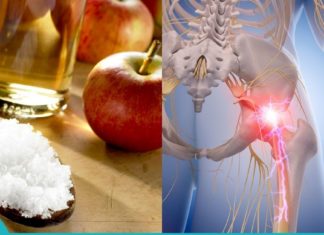 საჯდომის ნერვის ანთებისგან გათავისუფლდებით ამ მეთოდით სულ რაღაც 10 წუთში