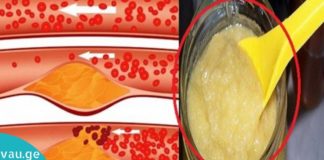 აი რა უნდა გააკეთოთ იმისათვის, რომ სისხლძარღვები იყოს სუფთა და ელასტიური