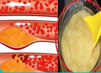 აი რა უნდა გააკეთოთ იმისათვის, რომ სისხლძარღვები იყოს სუფთა და ელასტიური