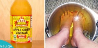 ნახეთ, რა მოუვა თქვენი ფეხის უხეშ კანს ძმარში ჩაყოფის შემდეგ