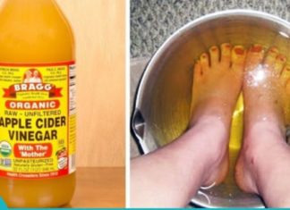 ნახეთ, რა მოუვა თქვენი ფეხის უხეშ კანს ძმარში ჩაყოფის შემდეგ