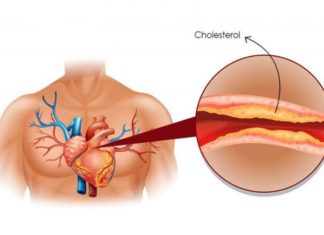 გთავაზობთ 10 მეთოდს, რომელთა დახმარებით ქოლესტერინის დონეს გააკონტროლებთ.
