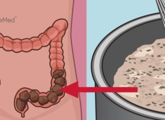 მსხვილი ნაწლავის გაწმენდა სახლის პირობებში ყველაზე ეფექტური მეთოდით