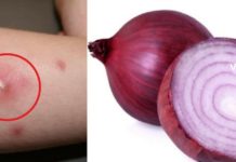 ძირმაგარას განკურნება ხალხური მეთოდებით