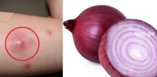 ძირმაგარას განკურნება ხალხური მეთოდებით