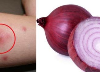 ძირმაგარას განკურნება ხალხური მეთოდებით