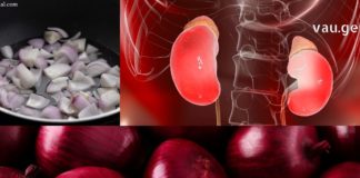 გაარჩიეთ 2 ცალი ხახვი, დაასხით 2 ლიტრი წყალი, შემდეგ დაამატეთ ეს ინგრედიენტები და თქვენი თირკმელები სრულიად გაიწმინდება.