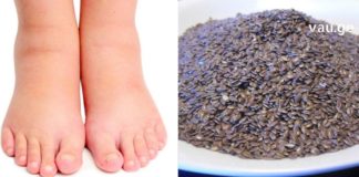 როგორ შევაჩეროთ ფეხების შეშუპება?